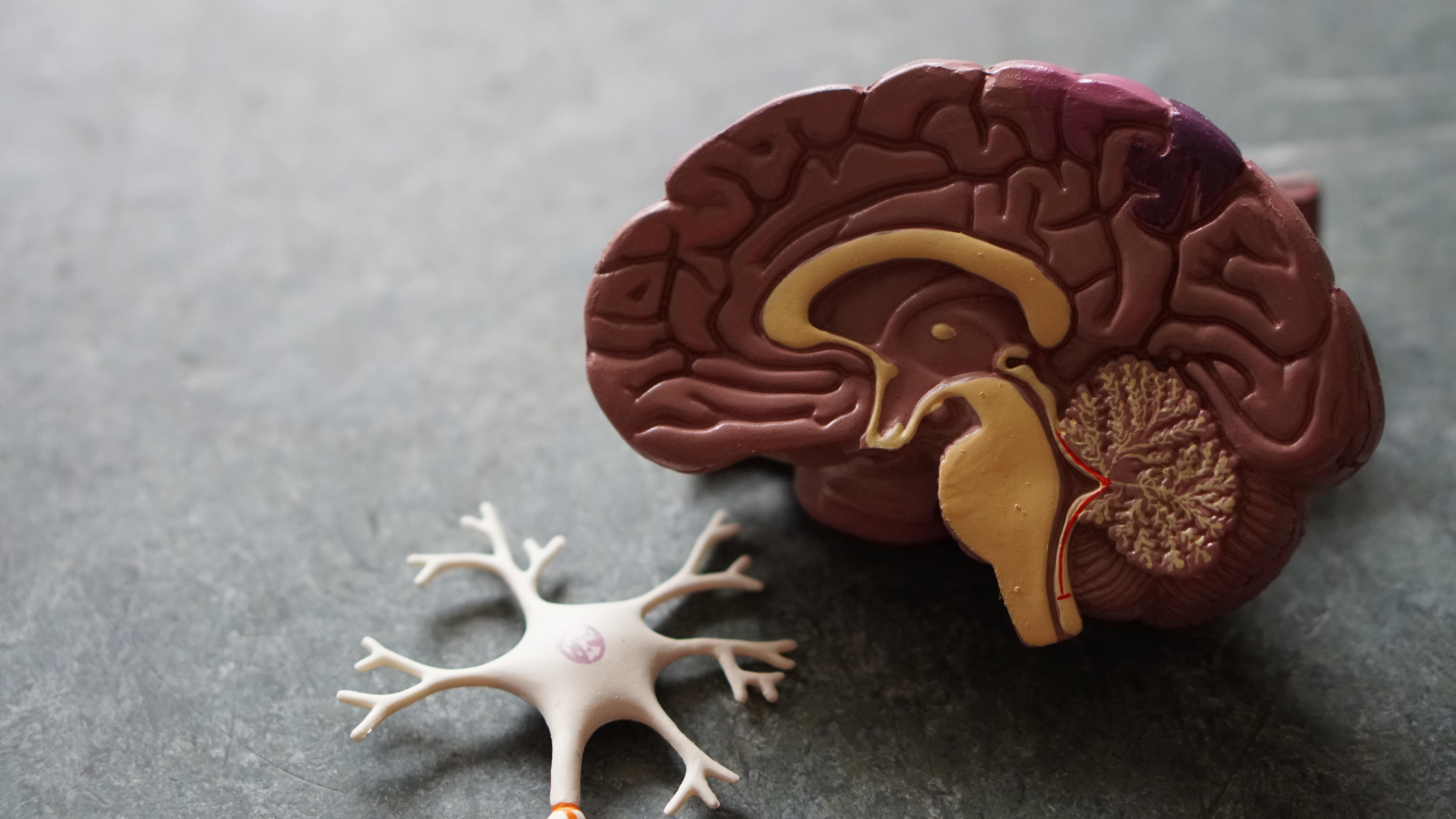 La esclerosis múltiple es la afección del sistema nervioso central, es decir, cerebro y la médula espinal.