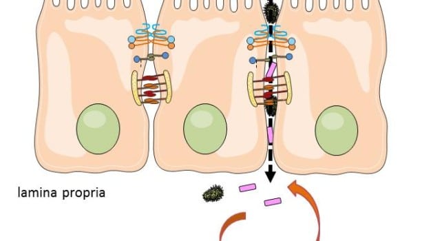 Permeabilidad intestinal