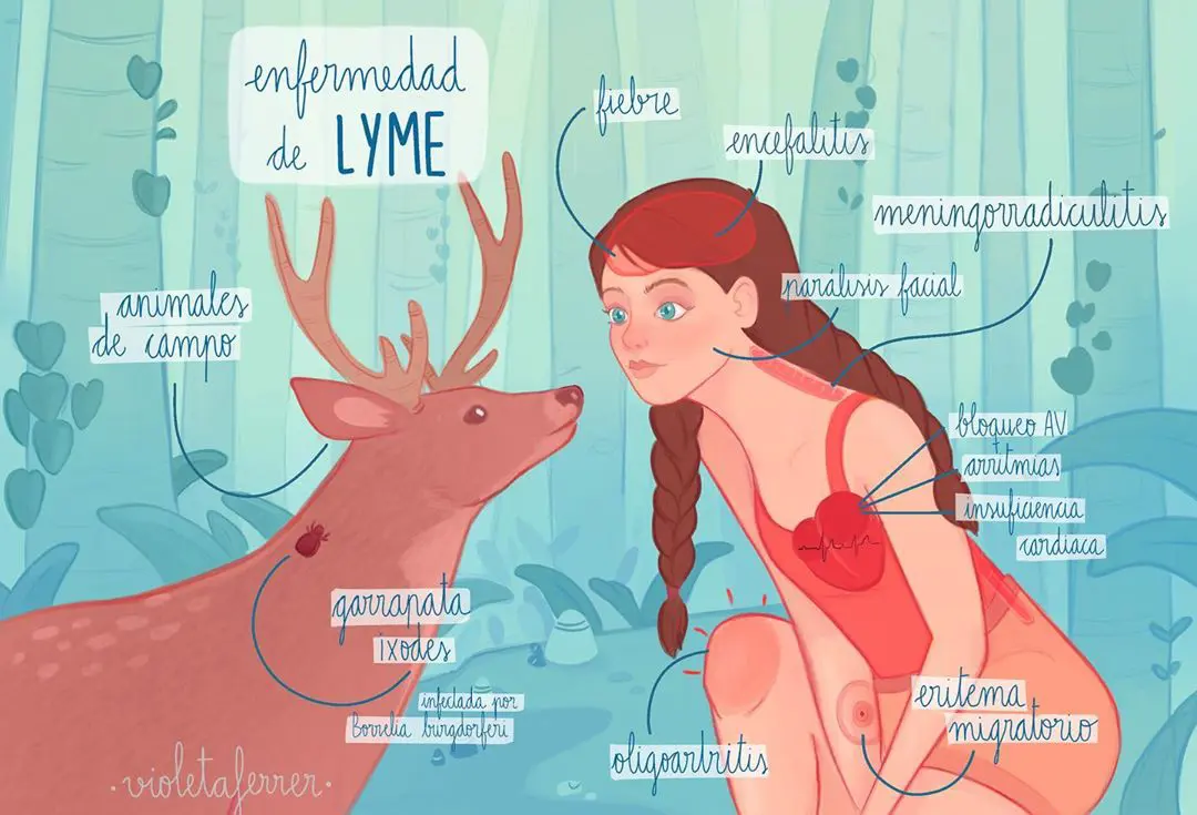 enfermedad de Lyme