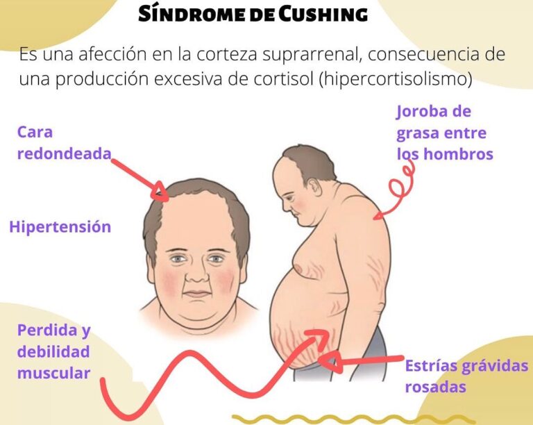 Síndrome de Cushing, ¿me está pasando a mí? Salud Diez