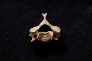 vertebra