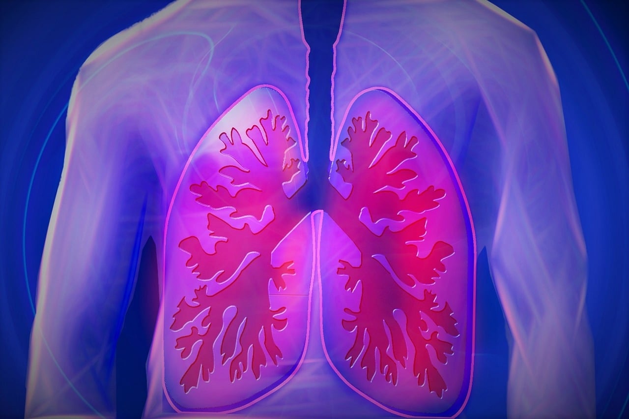 Pulmones con edema pulmonar