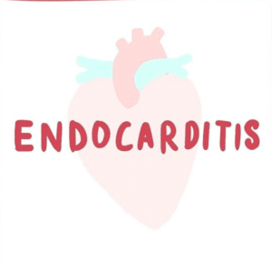 Endocarditis