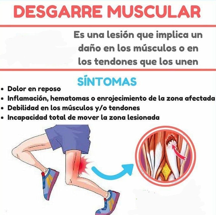 SÍNTOMAS DESGARRE MUSCULAR 