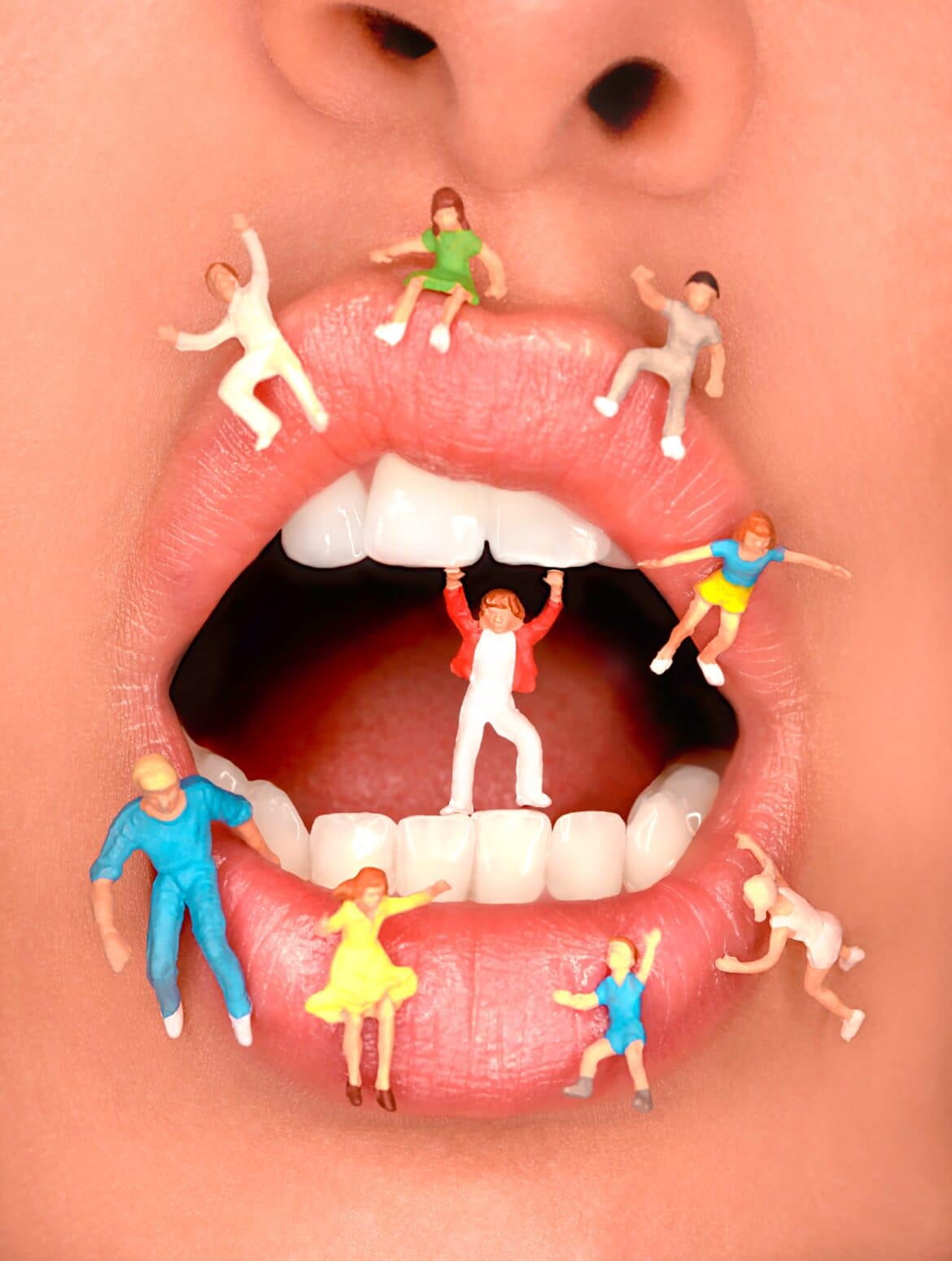 ¿Qué es una endodoncia y cómo evitar pasar por una?