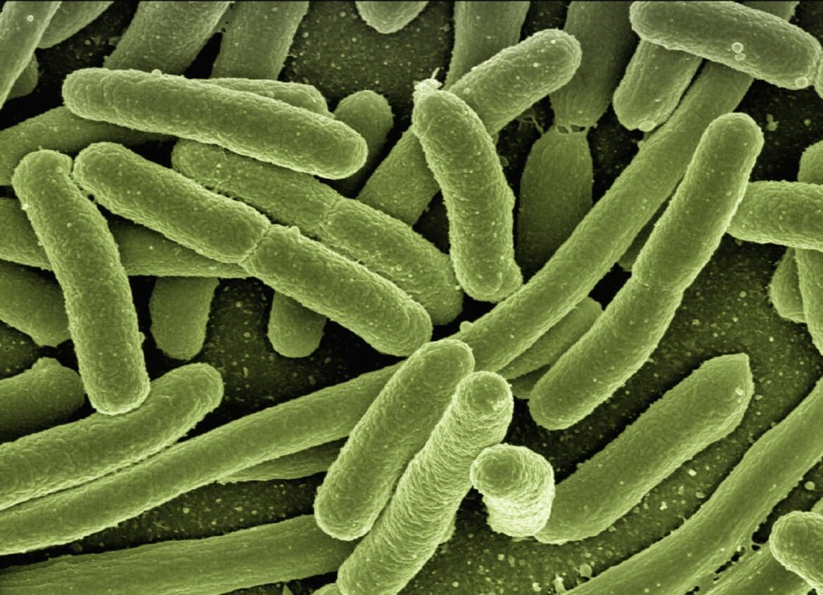 E. COLI: CONOCE TODO SOBRE ESTA BACTERIA