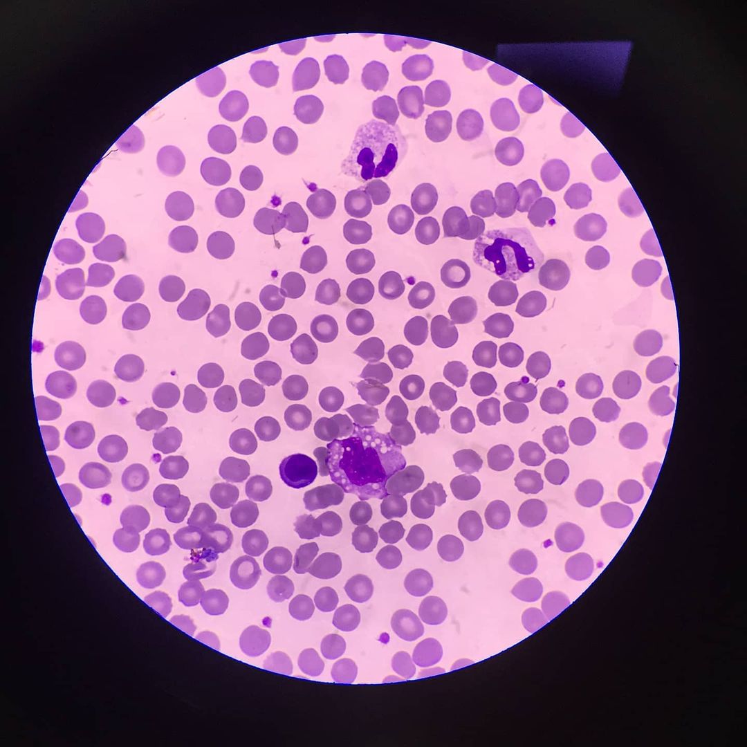 Imagen microscópica de eritrocitos o glóbulos rojos sanos