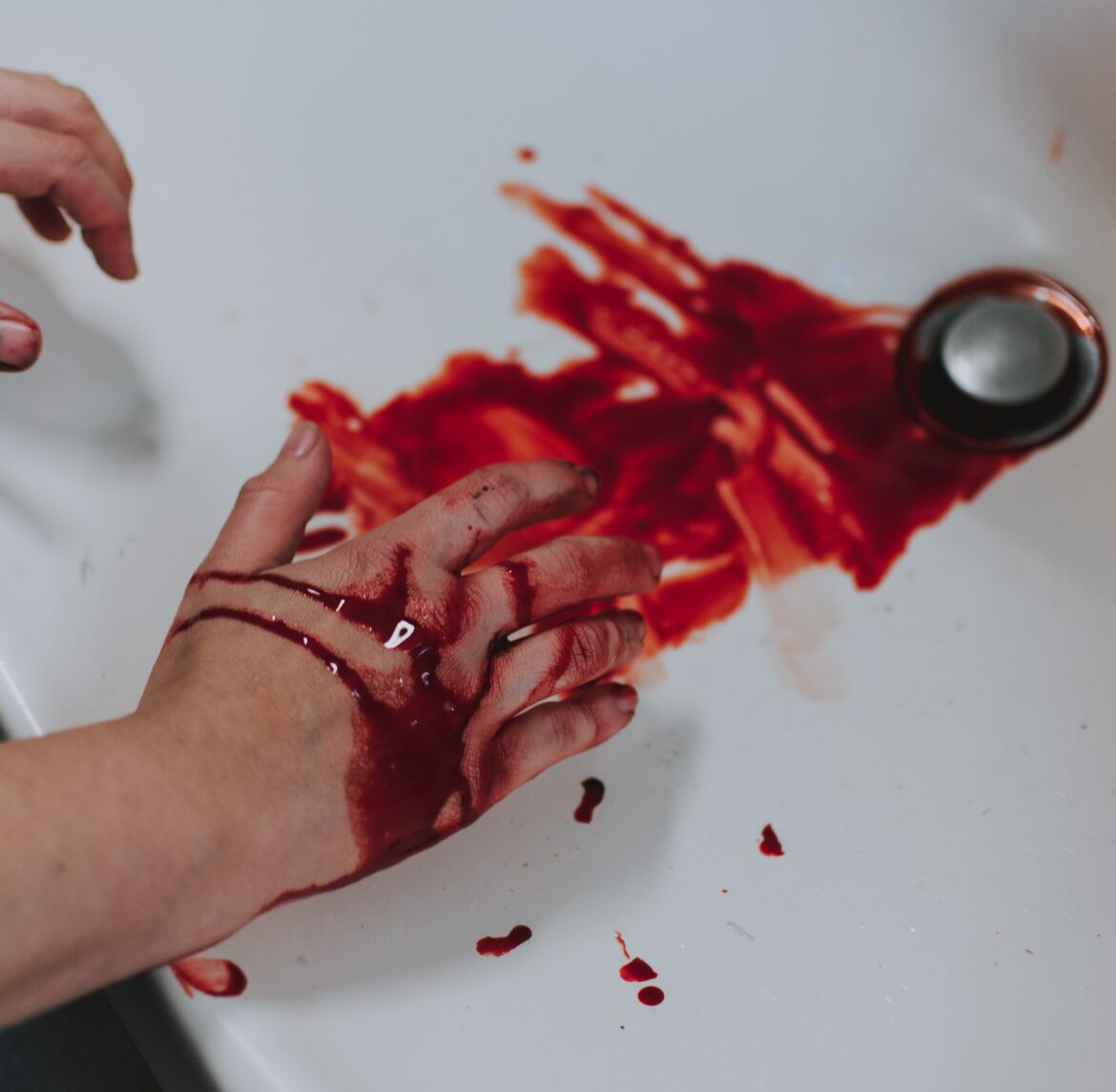 HEMOFILIA, PROBLEMAS CON LA COAGULACIÓN DE LA SANGRE